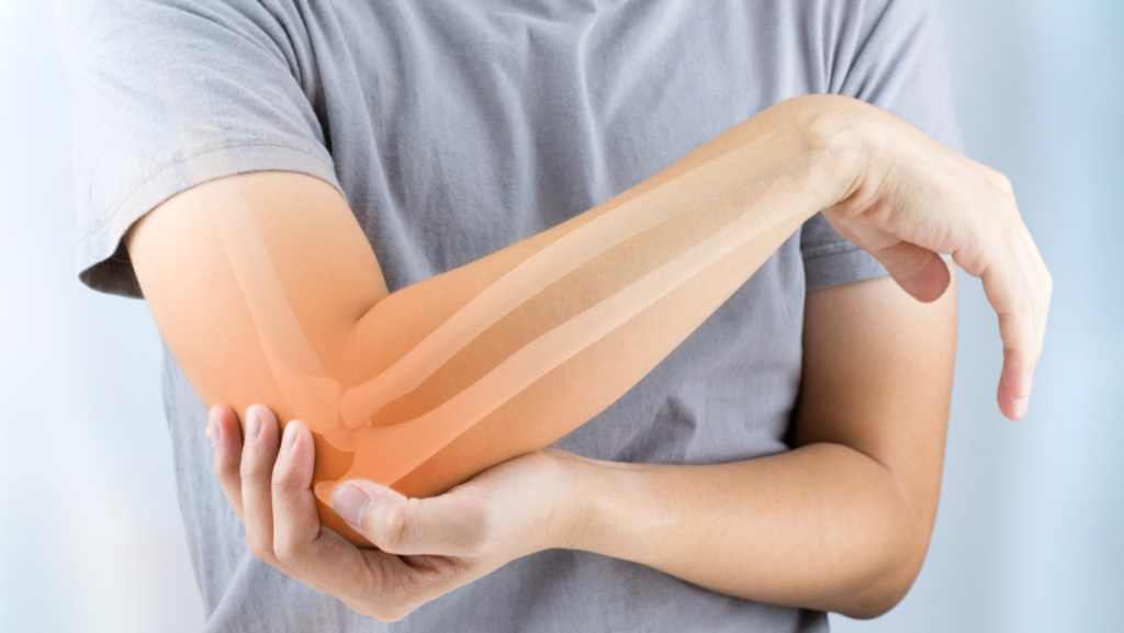 Lateral Epicondilitis