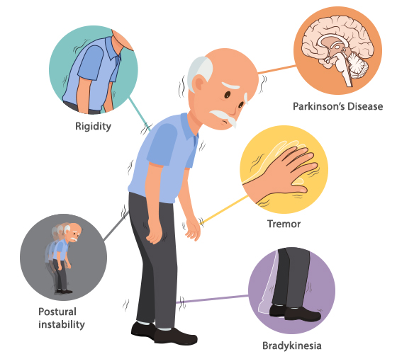 Parkinsons Disease Symptoms
